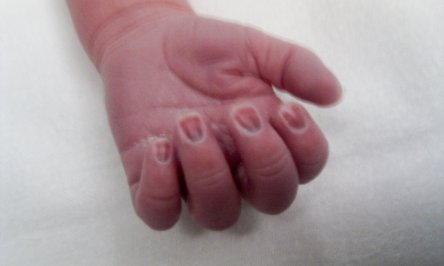 IMAG0133 Tiny fingers